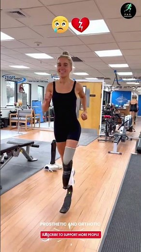 Girl Upgrades Her Prosthetic Leg — New Artificial Leg, New Confidence! | Prosthetic Transformation