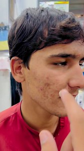 10K views · 167 reactions | Daily wish Beauty Cream Remove your face Freckle and Pimples | Majid Cosmetics Centre | Facebook