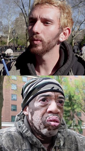 Understanding Vitiligo: A Personal Journey of Self-Acceptance