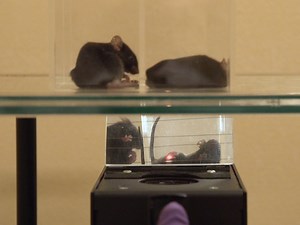 Dilution of Ziconotide for Intrathecal Trial: The Effect of Dilution on the Incidence of Side Effects and Pain Relief: A Single-center Retrospective Case-control Study - Watch Related Videos