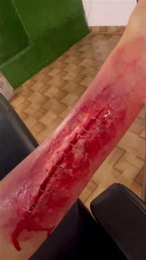 SFX MAKEUP FAKE CUT AND STITCHES #sfx #sfxstore #moviemakeup #prostheticmakeup