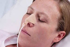 Nasogastric tube suction, nasogastric tube feeding & complications