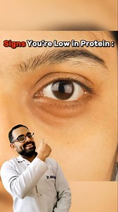 Signs You're Low In Protein : #LowProteinSigns #ProteinDeficiency #HealthyEating #NutritionTips #WellnessJourney | Dr Ankur Gautam