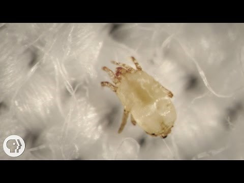 Meet the Dust Mites, Tiny Roommates That Feast On Your Skin | Deep Look