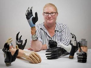 'Real bionic woman' becomes first person to have prosthetic limb fully merged with her body