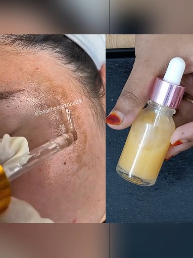 No Need Make Up to Hide Dark Spots ~ Try This Once & See the Difference! . . . #nomakeup #clean #darkspots #darkspotserum #skincare #glowingskin #healthcarezone24 | Health Care Zone