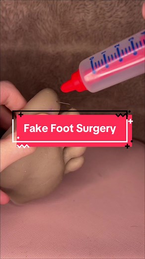 Fake Foot Surgery