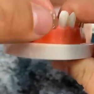 Watch Tooth Repair Granules on Amazon Live