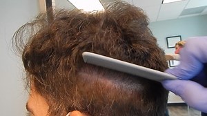 hanks to recent revolutionary advances, such as our exclusive...