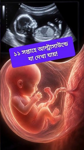 📌 What You Can See in an 11-Week Ultrasound | Pregnancy Week 11 Ultrasound Facts #pregnancy #shor...