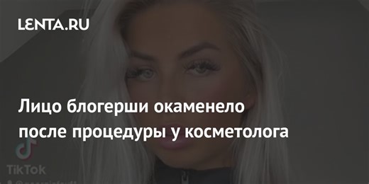 Лицо блогерши окаменело после процедуры у косметолога