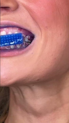 How to use disclosing tablets