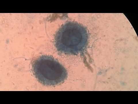 Sporangium and Sporangiospores