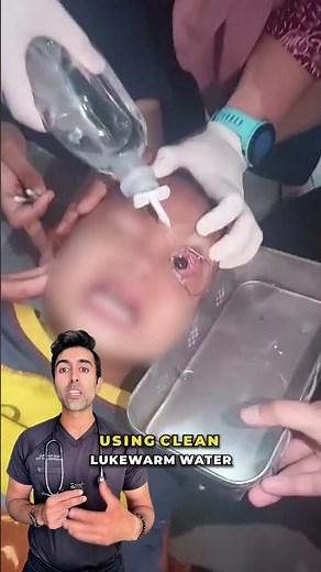 How to Safely Flush a Child's Eye