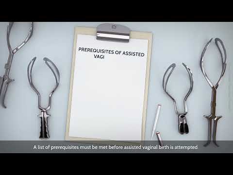 Assisted Vaginal Birth: An Overview