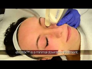 Sublative Rejuvenation with eMatrix