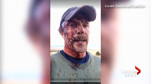 Man shares dramatic video after surviving two grizzly bear attacks