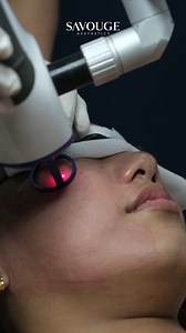 6.4K views | Makeup and filters can only do so much, but they cannot remove acne scars 헙헢헥 헥험헔헟! Get that scar-free skin with Savouge CO2 Fractional Laser. ✨  Multiple sessions and combined procedures are advised to achieve the best results  Available in all Savouge Aesthetics branches  Message us now to book your appointment! #CO2fractionallaser #savougeaesthetics #alagangsavouge #AcneScars #openporestreatment #acnemarks | Savouge Aesthetics Pampanga | Facebook