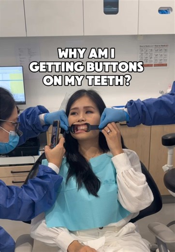 Starting My Linea Teeth Aligner Journey for Straighter Teeth