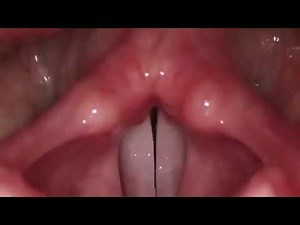 Vocal Cord Stroboscopy Examination (Meditalk)