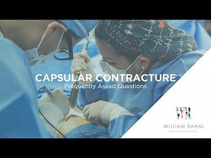 Capsular Contracture Frequently Asked Questions