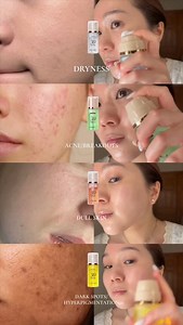 Which MENOKIN bubble mask is right for you? 🫧 Moist → cakey, dry skin 💧 Clear → acne breakouts 🍃 Lift → dull, tired skin ✨ Bright → dark spots & uneven tone 🌟 #kbeauty #koreanskincare #skincare #texturedskin #menokin | Song Of Skin