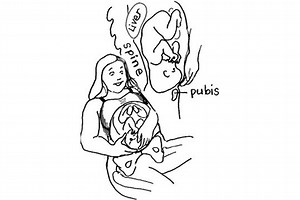 Engaging Baby in Labor - Spinning Babies