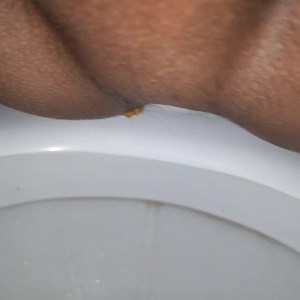 Got diarrhea - video 2