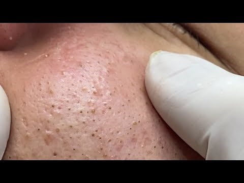 Satisfying and Relaxation with SURI NGUYEN Beauty Spa Video #206