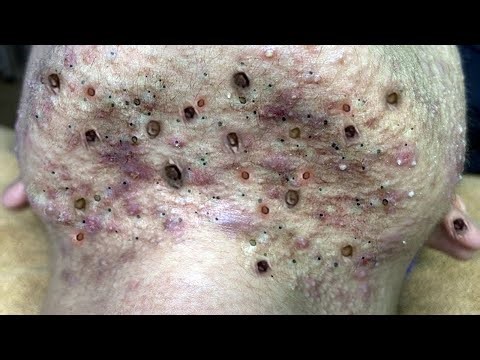 𝘗𝘦𝘳𝘧𝘦𝘤𝘵 𝘛𝘪𝘮𝘦 𝘍𝘳𝘰𝘮 𝘕𝘩𝘢𝘵 𝘉𝘢𝘯𝘨 𝘚𝘱𝘢