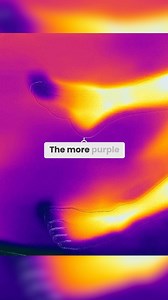 Did you know that if a child has poor blood flow to their fingers and toes, it may also affect their cognitive skills? #bloodflow #concentration #coldfingers #coldtoes #frontallobe #cognitiveskills #memoryrecall #wordrecall #attentionalneeds | Infinity Neuromotor Development Center
