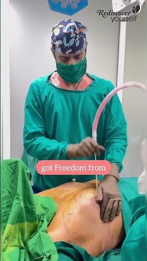 Freedom from Male Breasts - Gynecomastia Surgery
