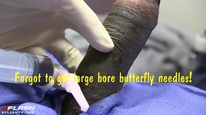 Nurse Observes Priapism Procedure