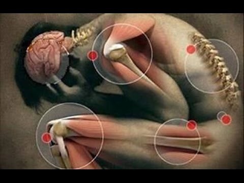 Reumatismo. Recetas para curar y prevenir el reumatismo.