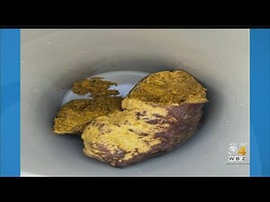 Boy Thinks Lump Found On Falmouth Beach Could Be Ambergris