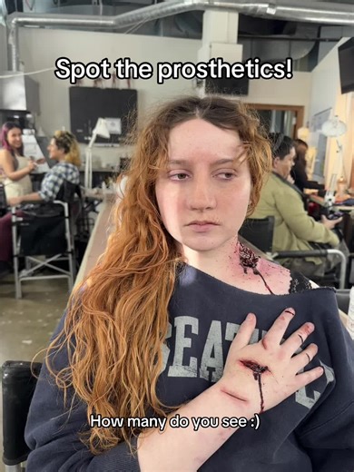 More from my prosthetics final there’s just the bite the scratch and the nose/lip piece! Proud of this one :) #sfx #prosthetic #prostheticnose #sfxmakeupartist #nose