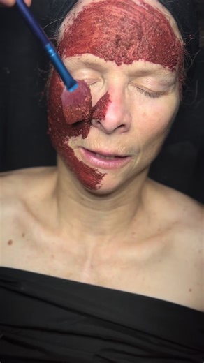 Did you know that some of the most talked-about skincare acids today have their roots in ancient Ayurvedic herbs? At Nirvah Beauty Ayurvedic Day Spa, we specialize in customizing every treatment to suit your skin’s unique needs, blending the power of Ayurveda with modern skincare science. Take our Rooted Glow Face Mask, for example. This luxurious blend starts with our signature base infused with saffron, known to brighten the skin and reduce pigmentation—similar to azelaic acid. We’ve enhanced 