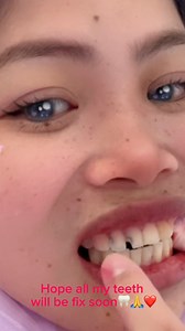 11 reactions | Tooth pulled out atlast!醴 My best valentines day殺#dentalcare #dentista #teethcare #teethcleaning #teethgoals #teethextraction #extractions #toothproblems #toothextraction #toothless #toothgems #toothsensitivity #toothbrush #toothache #oralhealth #oralcare #oralhygiene #oralsurgery #OralHealthMatters #orale #oralsurgeon | The Loudin Family | Facebook