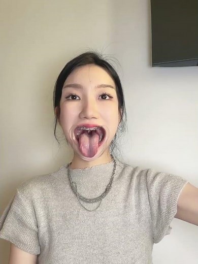 牙套美女口腔检查，完整版看下面简介说明，Mouth and Tongue uvula Throat Fetish Oral examination