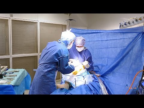 Reconstruction du ligament croisé antérieur à la Clinique Paris Lilas