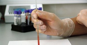 Quels sont les symptômes de la leucémie ?