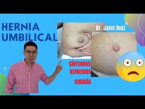 Hernia umbilical: Causas, síntomas, remedios, tratamiento