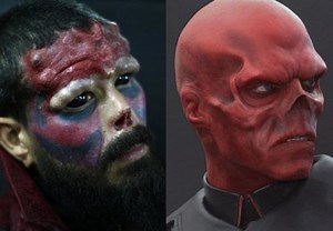 Extreme Modification: Man Chops Off His Nose To Look Like Marvel Comic Villain "Red Skull"
