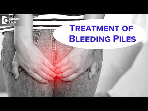 BLEEDING PILES | Stages of Piles, Fissures, Fistula & Homeopathic Cure-Dr.Rashmi K | Doctors' Circle