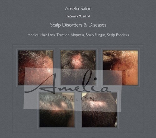 Trichologist Practitioner - Amelia Salon