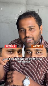 48K views · 11 reactions | One of our employees took the viral ퟒ-퐰퐞퐞퐤 퐜퐡퐚퐥퐥퐞퐧퐠퐞 with Vilvah's Under Eye Cream and the results?  "I saw visibly brighter under eyes in 퐣퐮퐬퐭 ퟒ 퐰퐞퐞퐤퐬. I highly recommend it to everyone!" - Sudharson. Brighter under eyes at 퐅퐥퐚퐭 ퟐퟎ% 퐎퐟퐟. | Vilvah store | Facebook