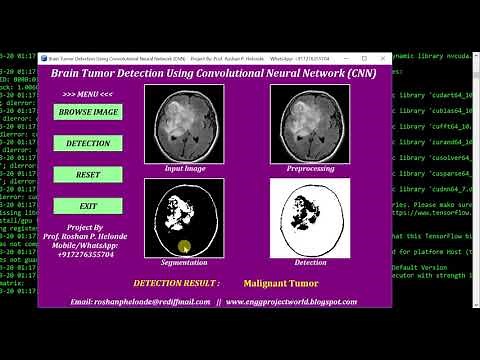 Brain Tumor Detection Using Convolutional Neural Network (CNN) | Python Project With Source Code