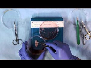 Dissection of a Whole Ovary in Preparation for Cryopreservation
