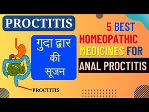 Proctitis Symptoms and Treatment | Top 5 Homeopathy Medicine for Proctitis