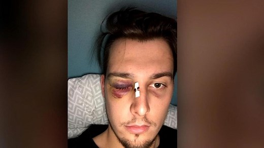 Une scène d'une déplorable violence au hockey senior AAA